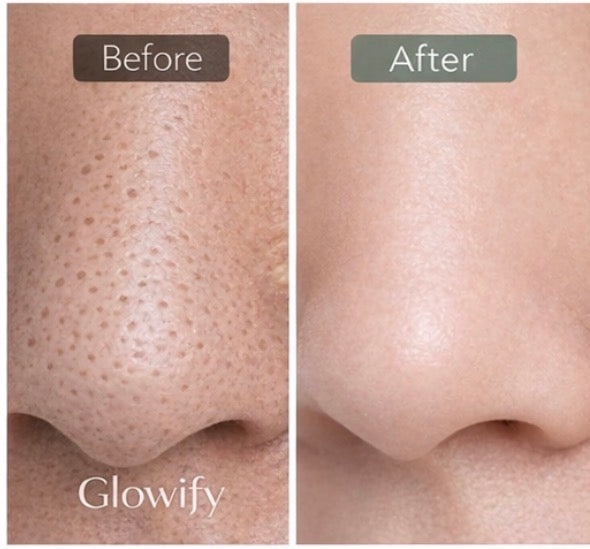 SÈLUNE PARIS® Pore Refining Device